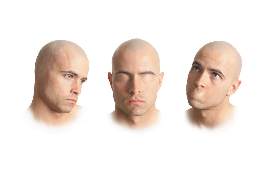 Three Conceptual Photos Of A Bald Caucasian Man Without Ears Without Eyes And Without A Mouth Photograph by Photodisc