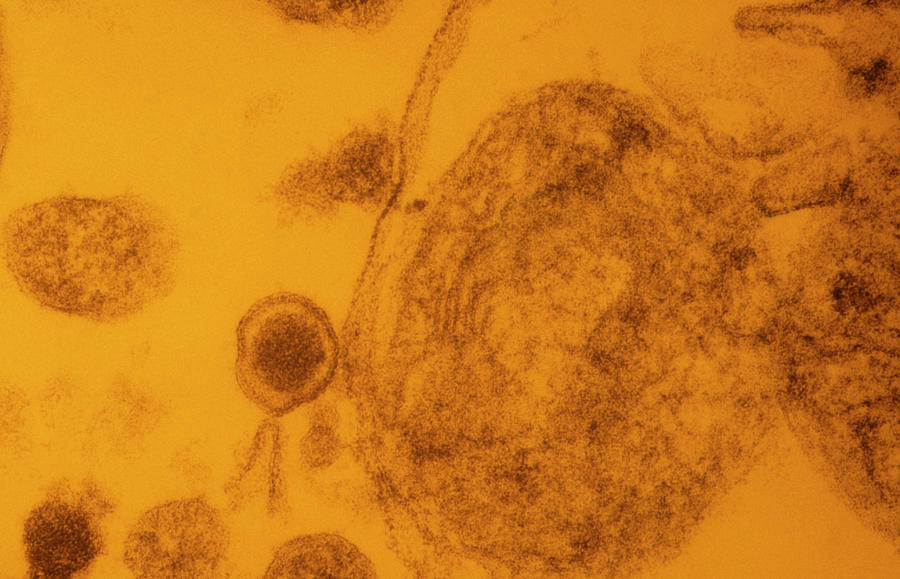 Tinted Tem Of Aids Virus Budding From T-cell Photograph by Nibsc/science Photo Library