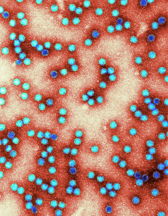 Tobacco Necrosis Virus by Centre For Bioimaging, Rothamsted Research ...