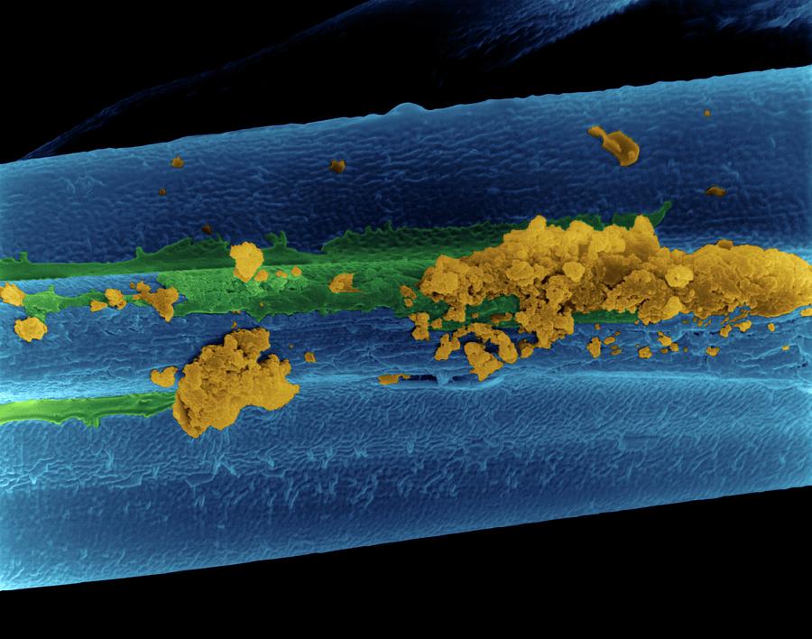 Tobacco Smoke Particles On Filter Fibre Photograph by Dennis Kunkel Microscopy/science Photo Library