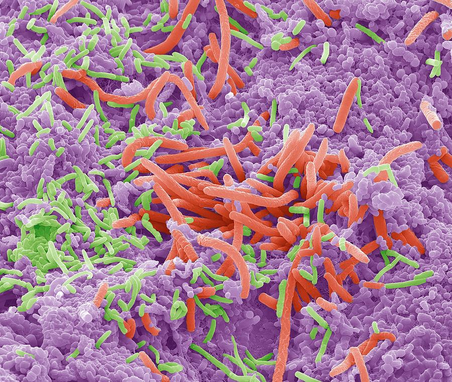 Бактерии на языке фото