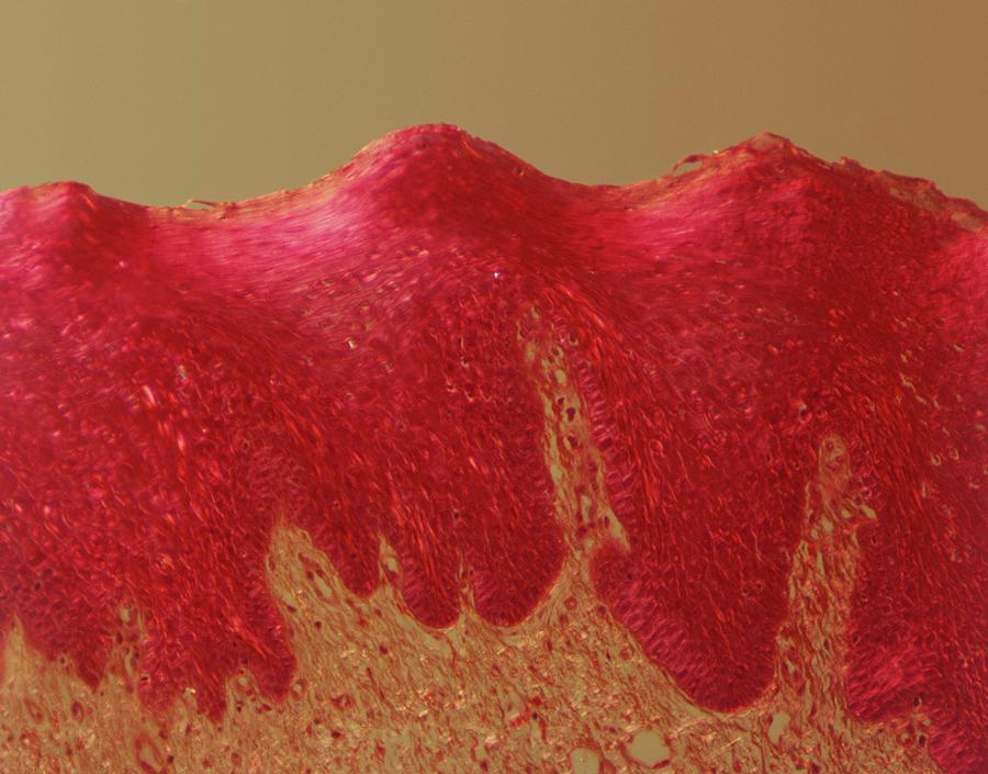 Tongue Tissue Photograph by Cnri/science Photo Library