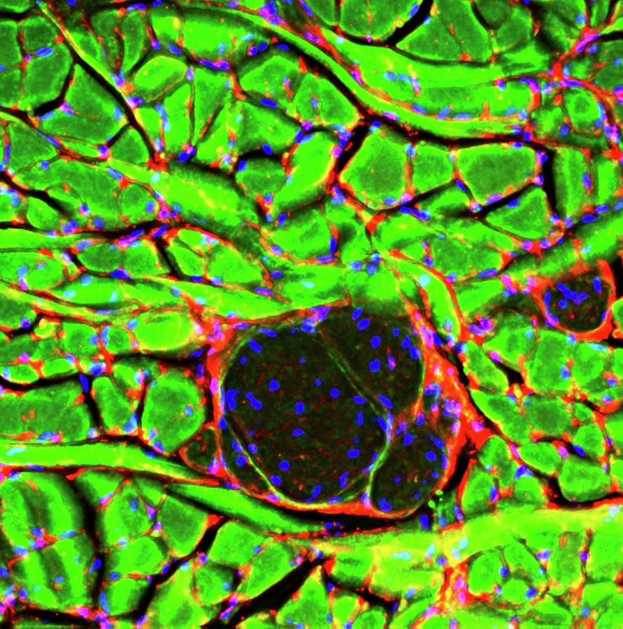 Tissue Photograph - Tongue Tissue by R. Bick, B. Poindexter, Ut Medical School Tissue Photograph - Tongue Tissue by R. Bick, B. Poindexter, Ut Medical School