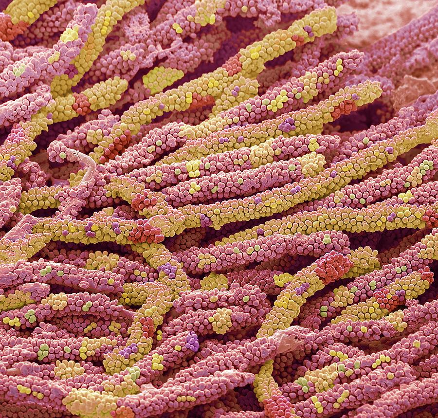 Tooth Bacteria Photograph By Steve Gschmeissnerscience Photo Library