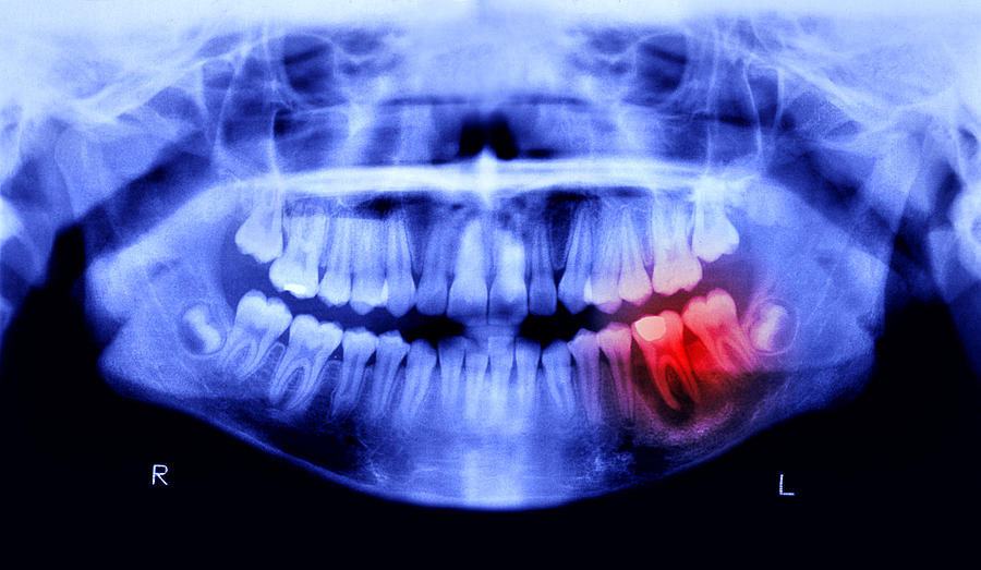 Toothache pain Photograph by Peter Dazeley