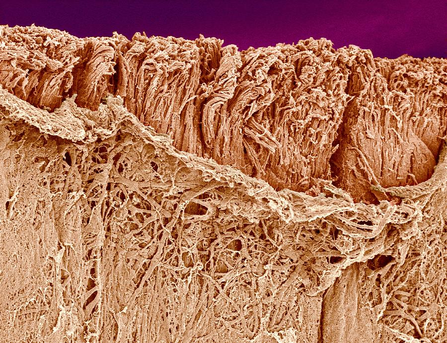 Trachea muscle, SEM Photograph by Science Photo Library