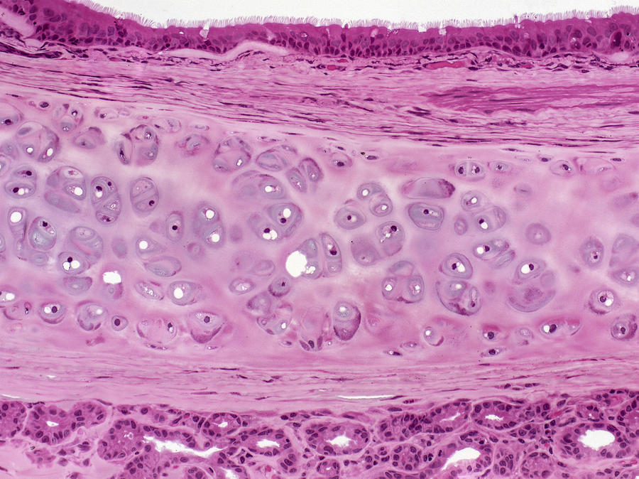 Trachea Respiratory Epithelium, Lm Photograph by Alvin Telser