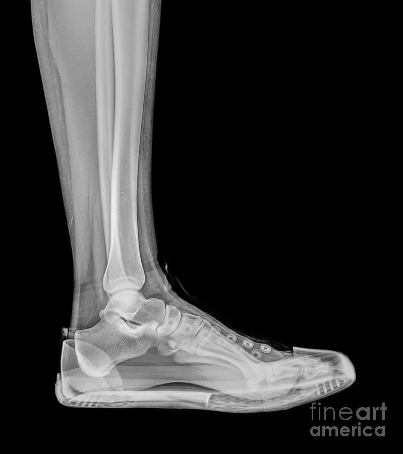 Trainers  X-Ray  Photograph by Guy Viner