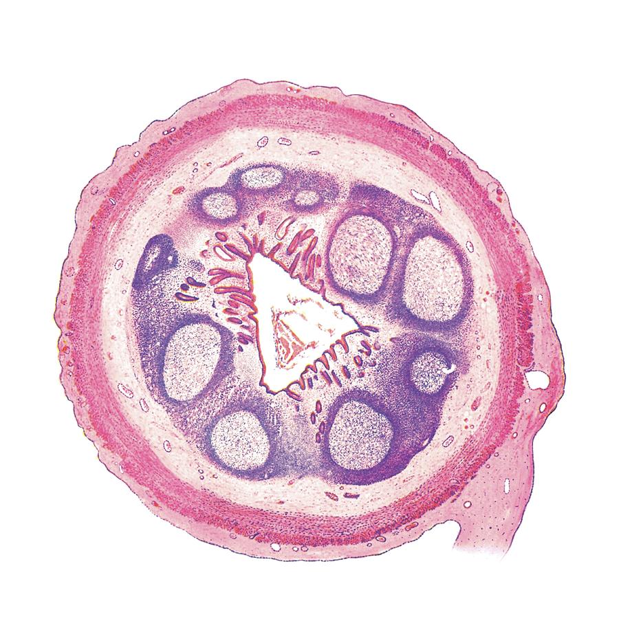 Transverse Section Of Appendix Photograph by Asklepios Medical Atlas