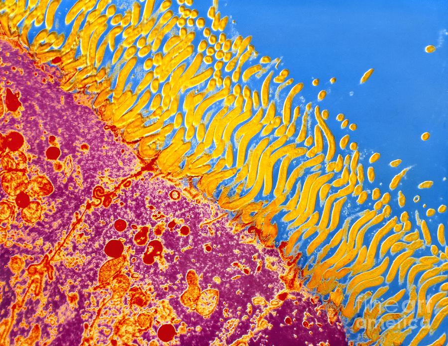 Duodenum Photograph - Treponema Bacteria In Duodenum by Jackie Lewin, Em Unit Royal Free Hospital/ Science Photo Library
