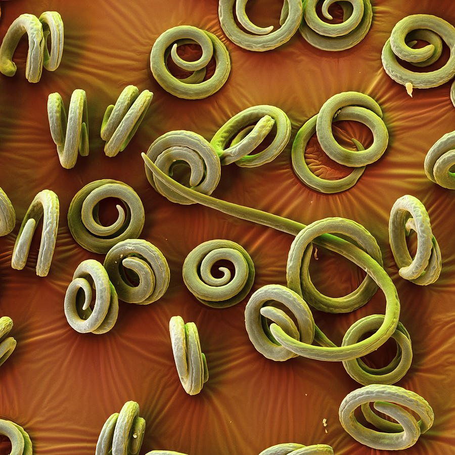 Trichinella Spiralis Photograph by Eye of Science