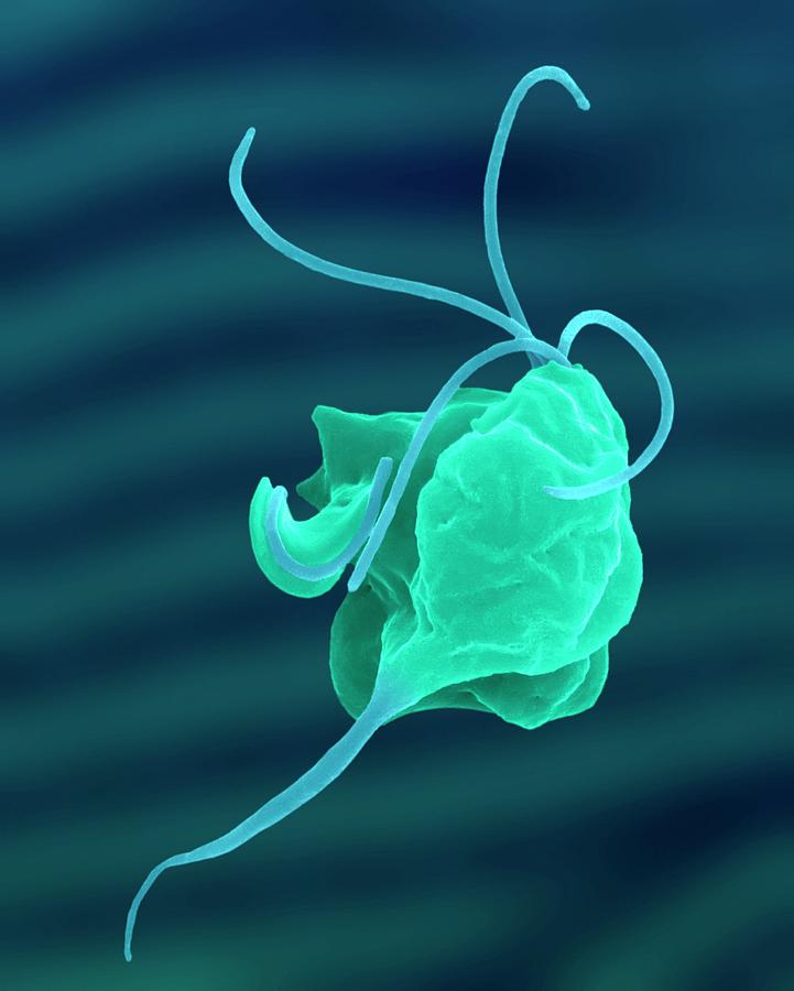 Protozoan Photograph - Trichomonas Vaginalis Parasitic Protozoan by Dennis Kunkel Microscopy/science Photo Library