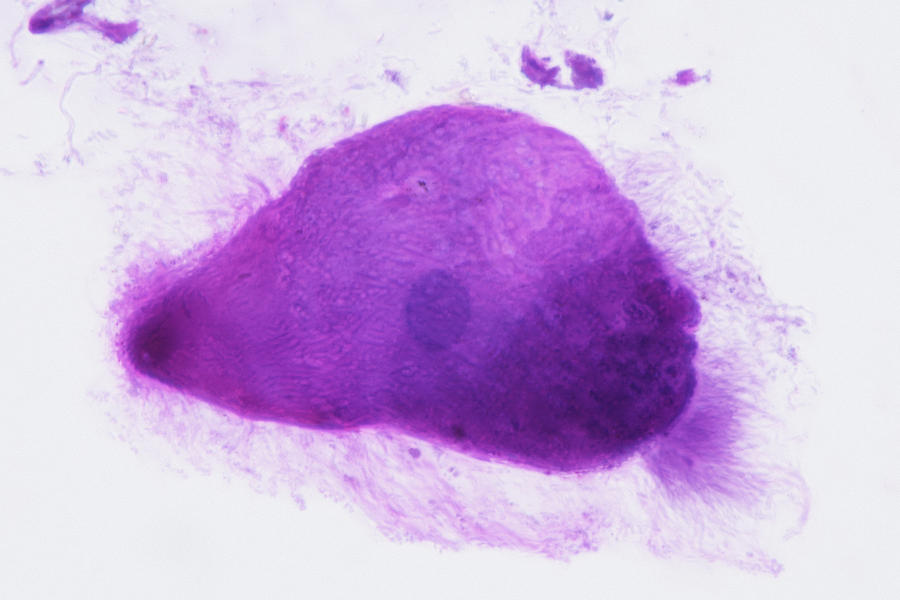 Trichonympha Ciliate Protozoan In Gut Photograph by Science Stock Photography