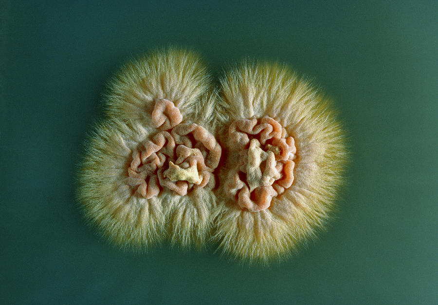 Trichophyton Fungus Photograph by Perennou Nuridsany