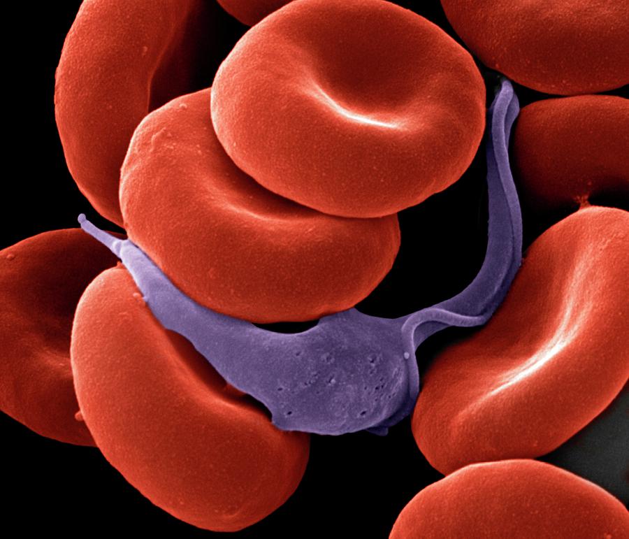 Blood Photograph - Trypanosome Amongst Blood Cells by Clouds Hill Imaging Ltd