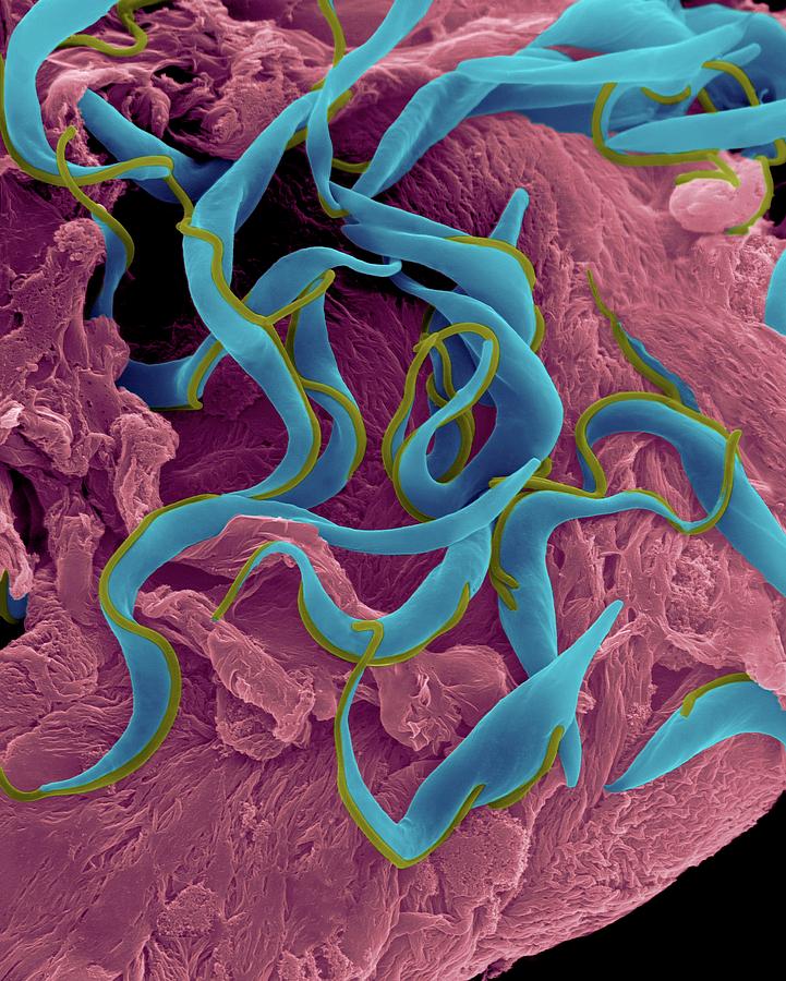 Trypanosome Trypomastigote Protozoan Photograph by Dennis Kunkel Microscopy/science Photo Library