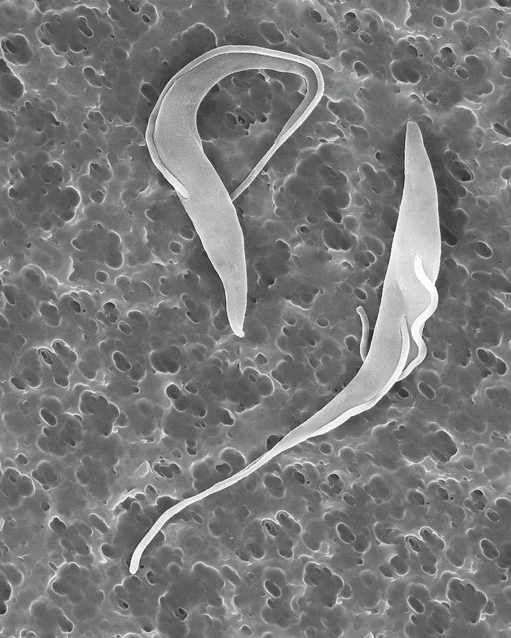 Black And White Photograph - Trypanosome Trypomastigotes Protozoa by Dennis Kunkel Microscopy/science Photo Library
