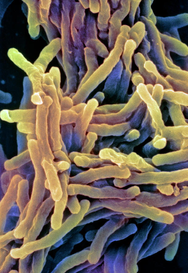 Tuberculosis Bacteria Photograph by A. Dowsett, Public Health England/science Photo Library