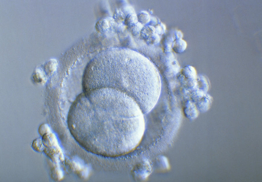 Blastomere Photograph - Two-cell Embryo by Pascal Goetgheluck/science Photo Library