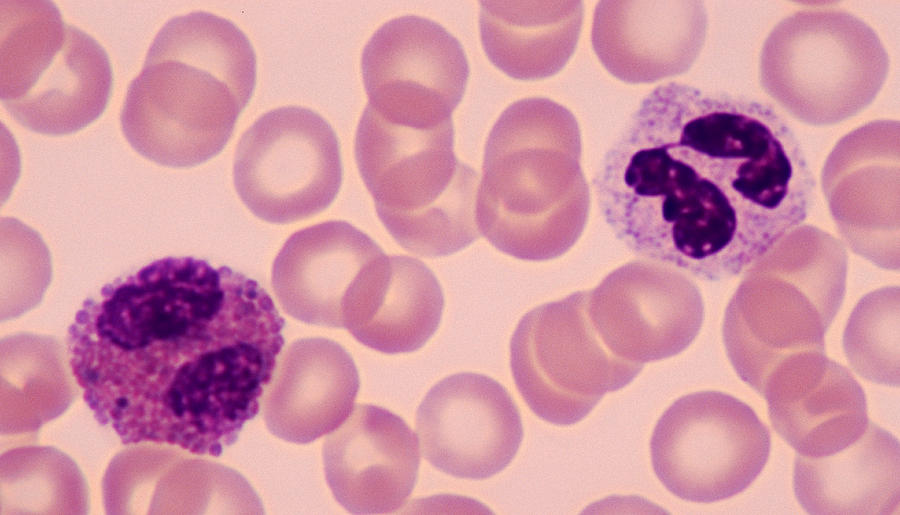 Two WHITE BLOOD CELLS or LEUKOCYTES--NEUTROPHIL (right) and EOSINOPHIL (left), human blood smear, 500X Photograph by Ed Reschke