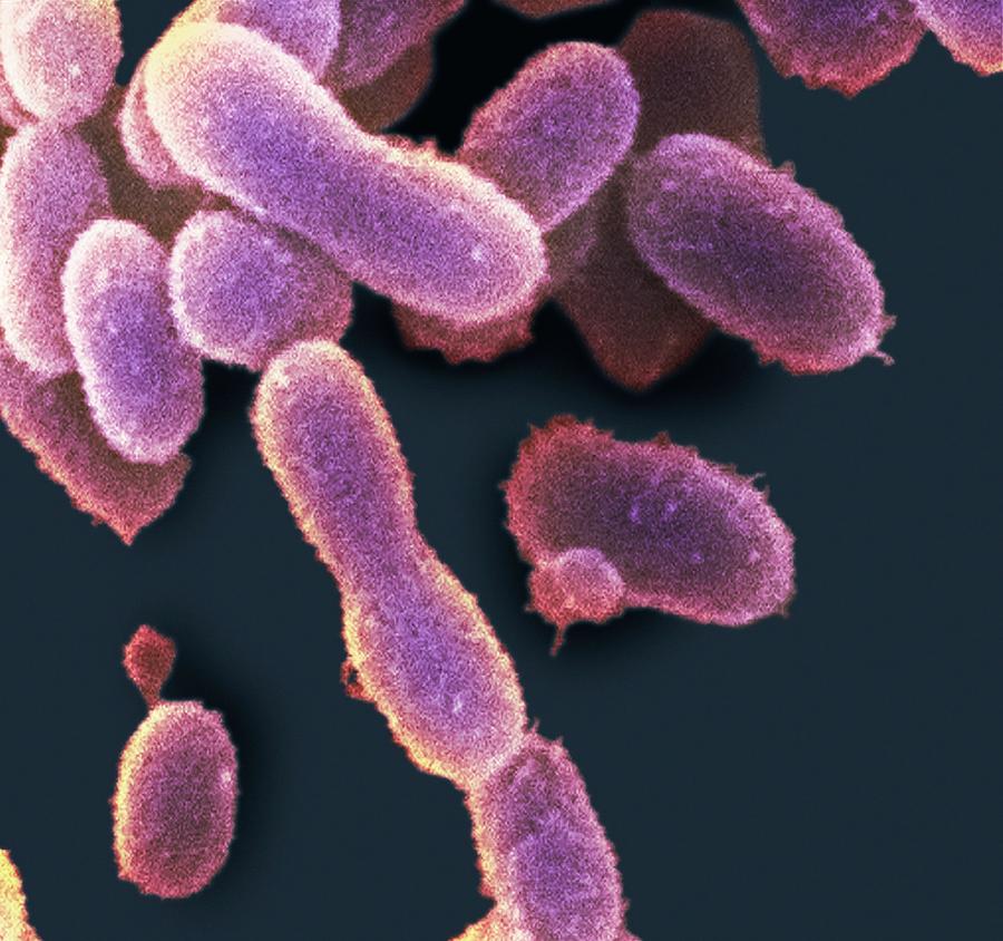 Ultra-small Extremophile Bacteria Photograph by Penn State University/science Photo Library