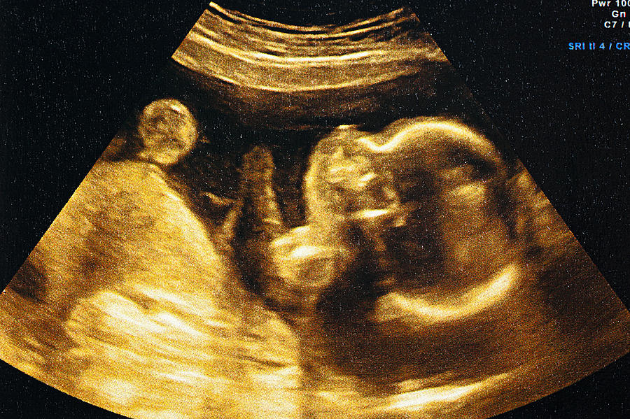 Ultrasound of a womans fetus at 37 weeks Photograph by Pedre