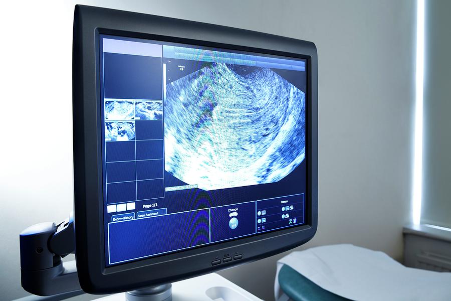 Ultrasound Scan Photograph by Science Photo Library Fine Art America