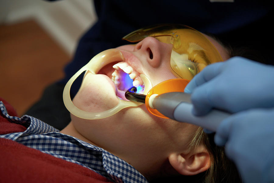 Undescended Tooth Treatment Photograph by Antonia Reeve/science Photo Library