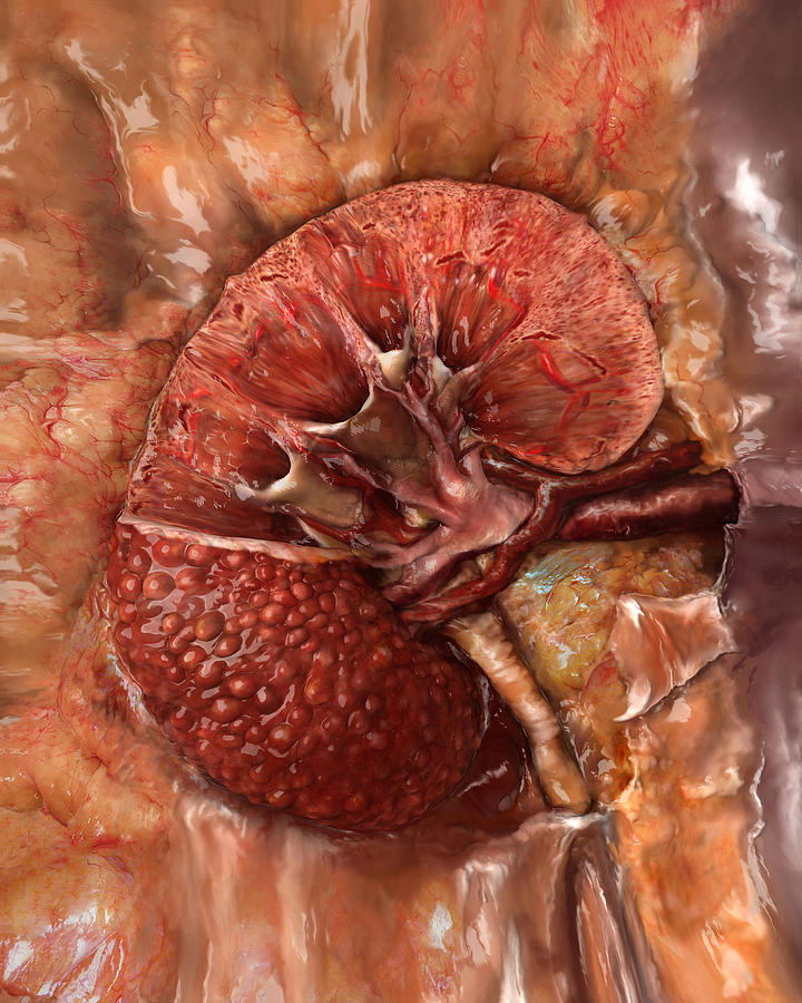 Unhealthy Kidney, Sectioned Photograph by Anatomical Travelogue