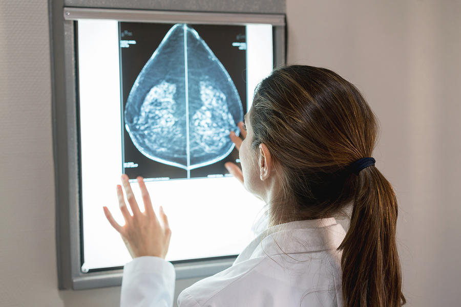 Unrecognizable female gynocologist looking at a mammogram at the hospital Photograph by Andresr