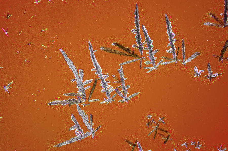 Uric Acid Crystals Photograph by John Durham
