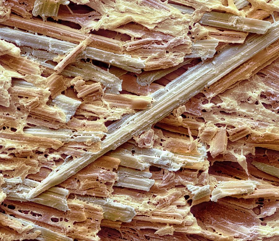 Uric Acid Crystals Photograph by Steve Gschmeissner