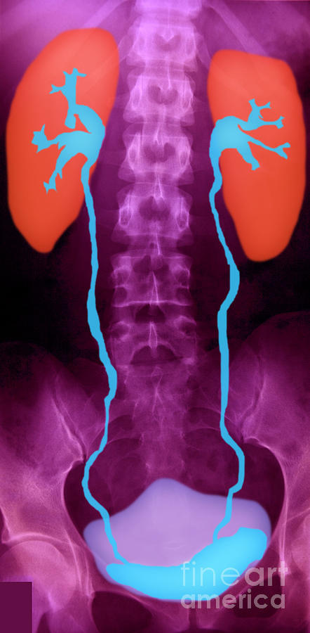 Urinary System X-ray Photograph by Warrick G