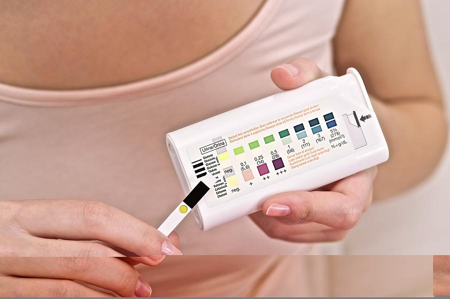 Urine diabetes test Photograph by Science Photo Library