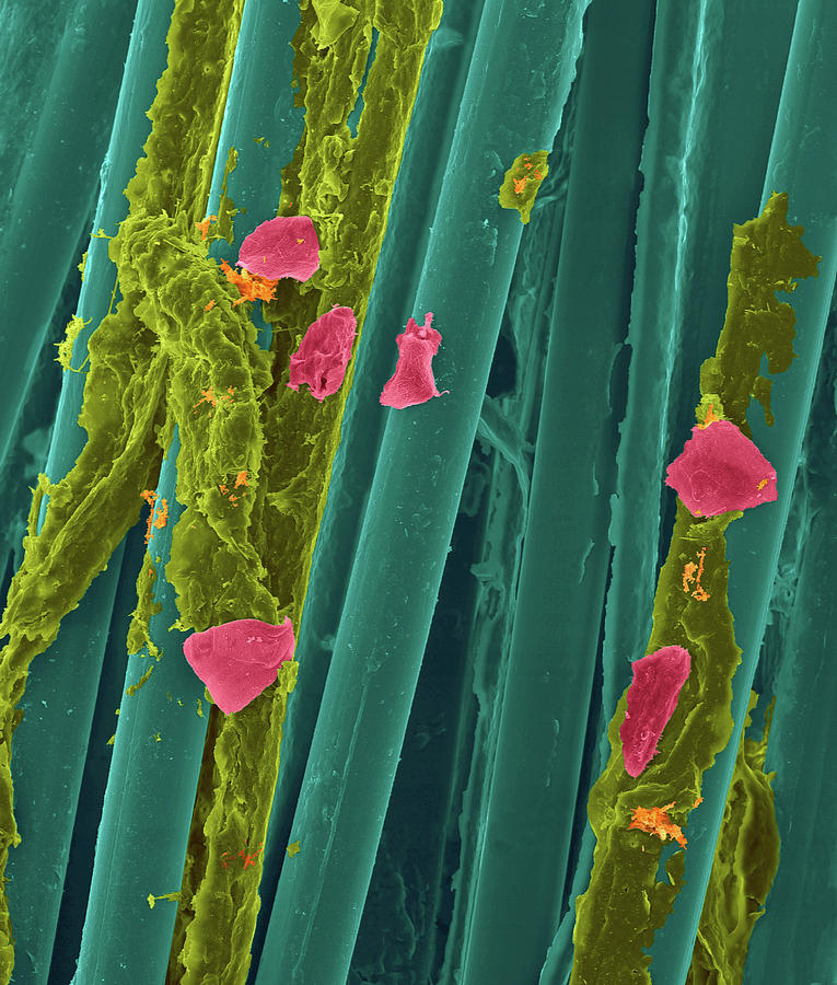 Used Wax Dental Floss Photograph by Dennis Kunkel Microscopy/science Photo Library