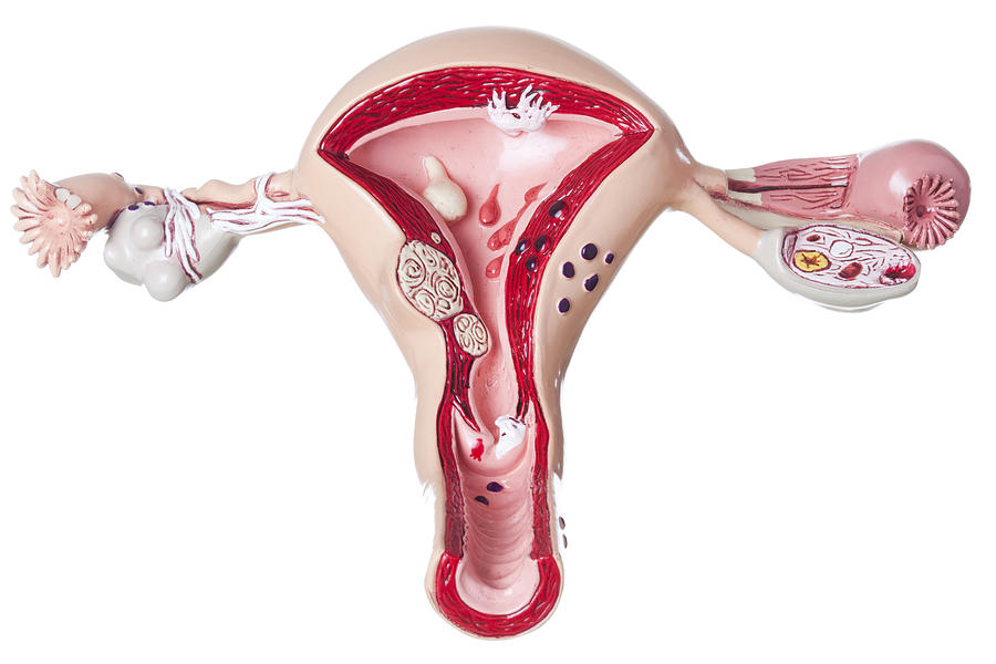 Uterus and ovaries on white background Photograph by Ericsphotography