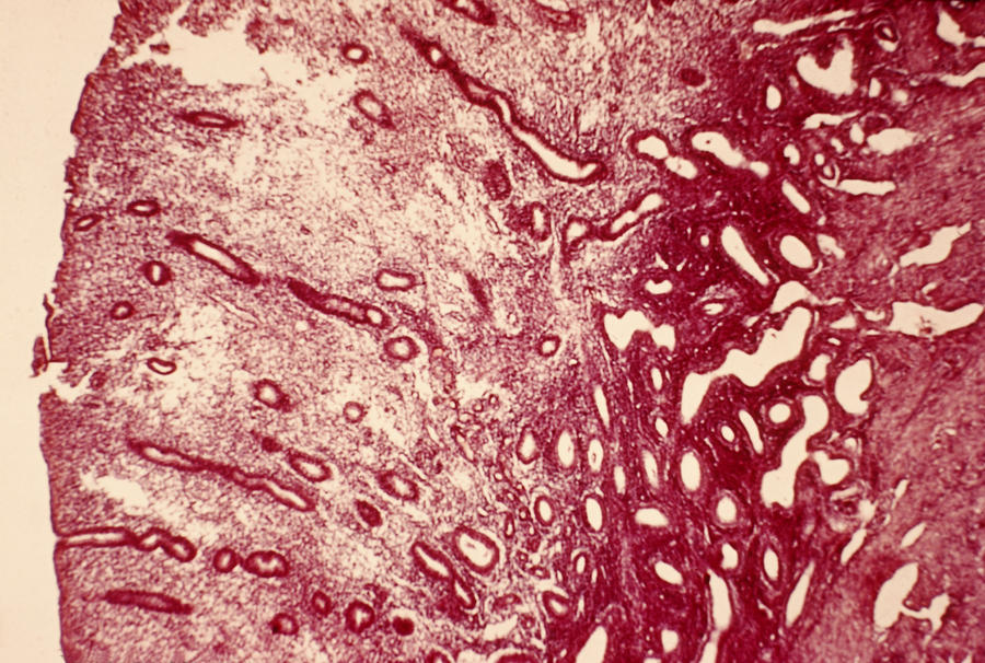 Uterus Photograph by Biology Pics