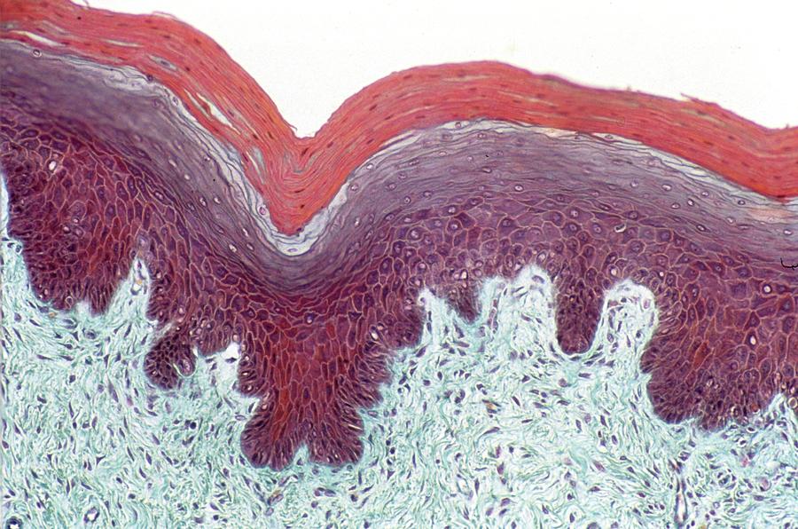 Uterus Photograph by Secchi-lecaque/roussel-uclaf/cnri
