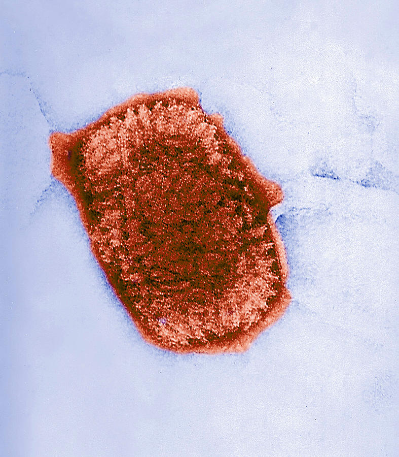 Vaccinia Virus, Eradicated Smallpox, Tem Photograph by Science Source