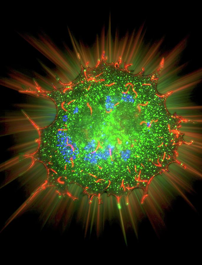 Vaccinia Virus Infected Cell Photograph by Dr Dan Kalman , Katie Vicari/science Photo Library
