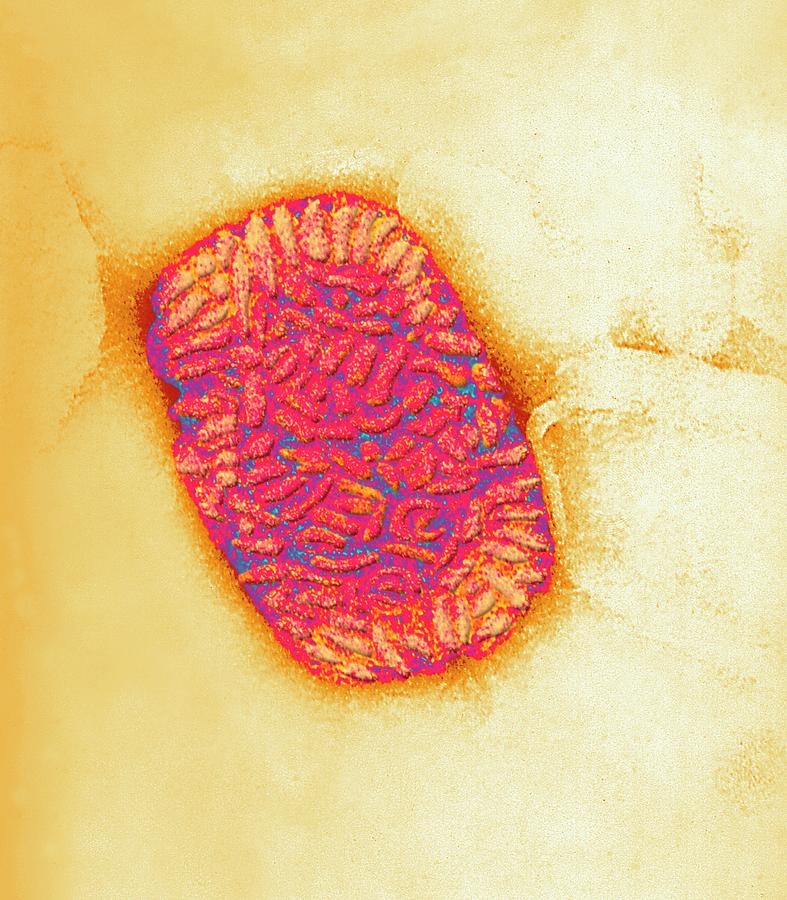 Vaccinia Virus Particle Photograph by Ami Images/science Photo Library
