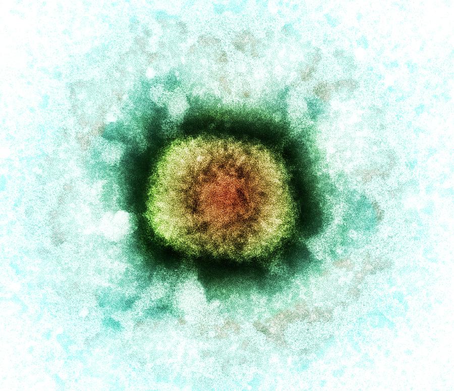 Vaccinia Virus Particle Photograph by Heather Davies/science Photo Library
