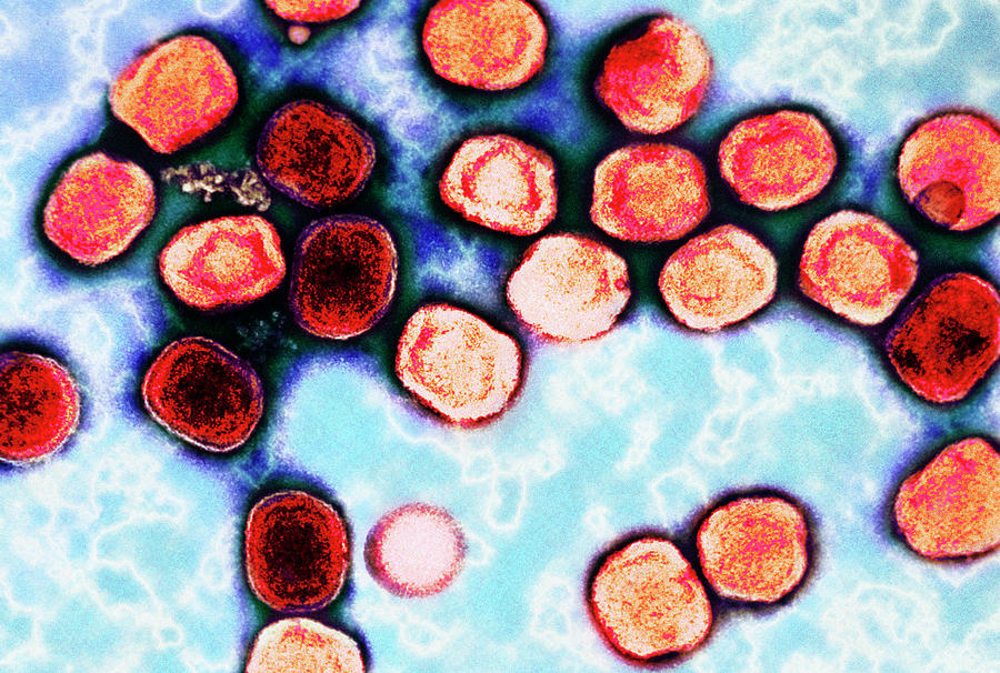 Vaccinia Virus Particles Photograph by Cdc/science Photo Library
