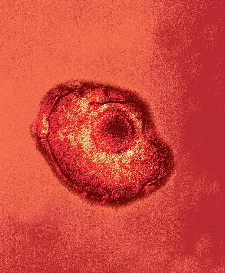 herpes zoster virus microscope