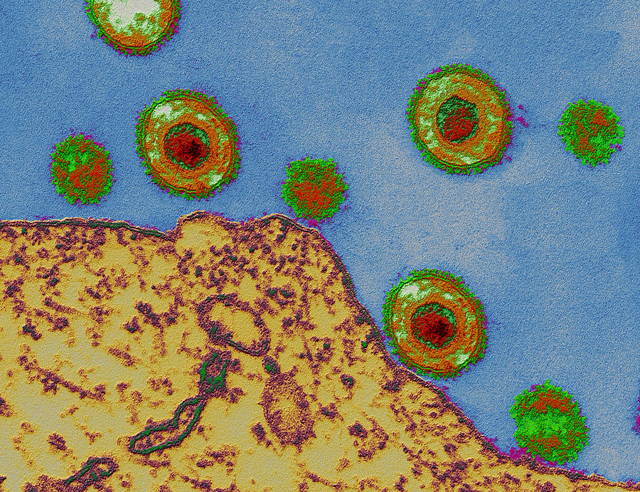 Varicella Zoster Viruses Photograph by Eye of Science
