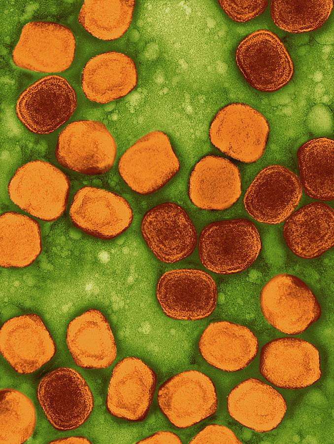 Variola Virus Photograph by Dennis Kunkel Microscopy/science Photo Library