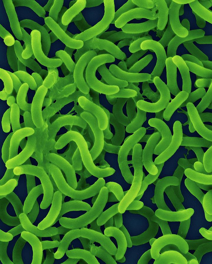vibrio cholerae microscope