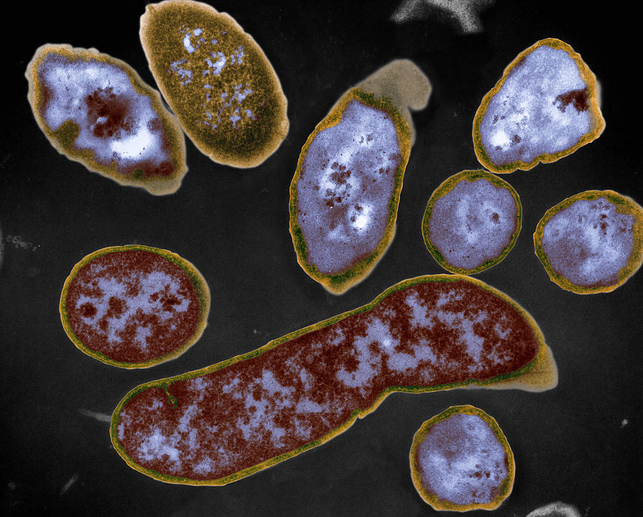 Трутовик окаймленный холерный вибрион. Холерный вибрион в микроскопе. Холера бактерия. Клетка холеры под микроскопом.