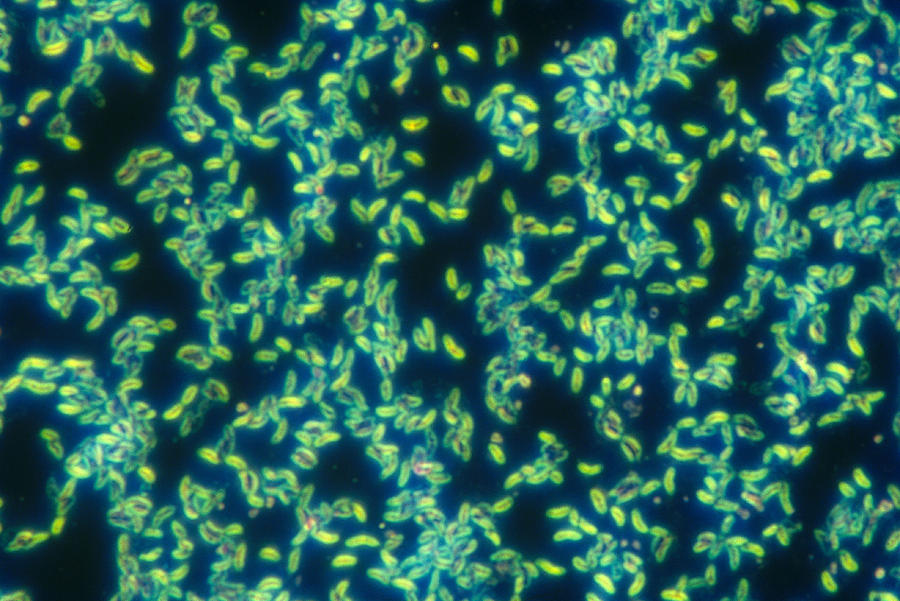 Vibrio Cholerae, Lm Photograph by Michael Abbey