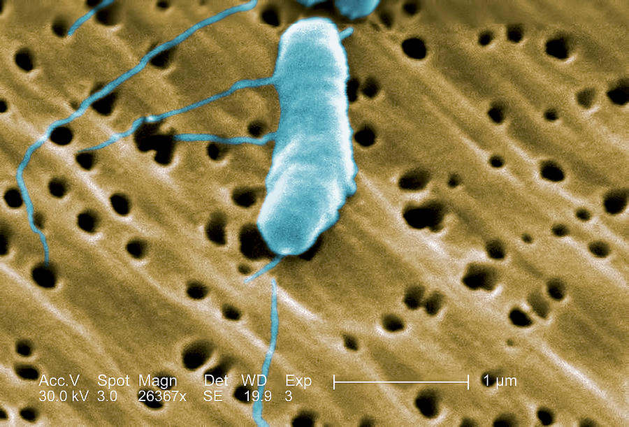 Vibrio Vulnificus, Sem Photograph by Science Source